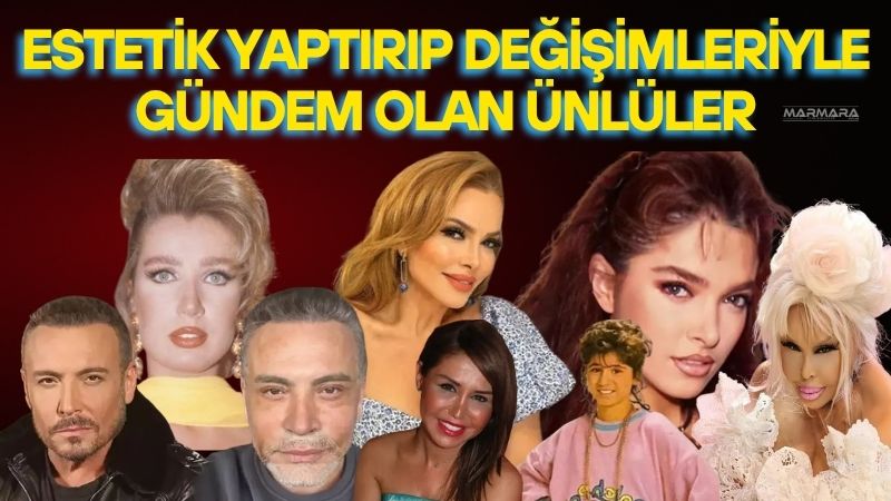 Türk magazin dünyasında estetik ameliyatlar, botoks ve dolgu uygulamaları uzun