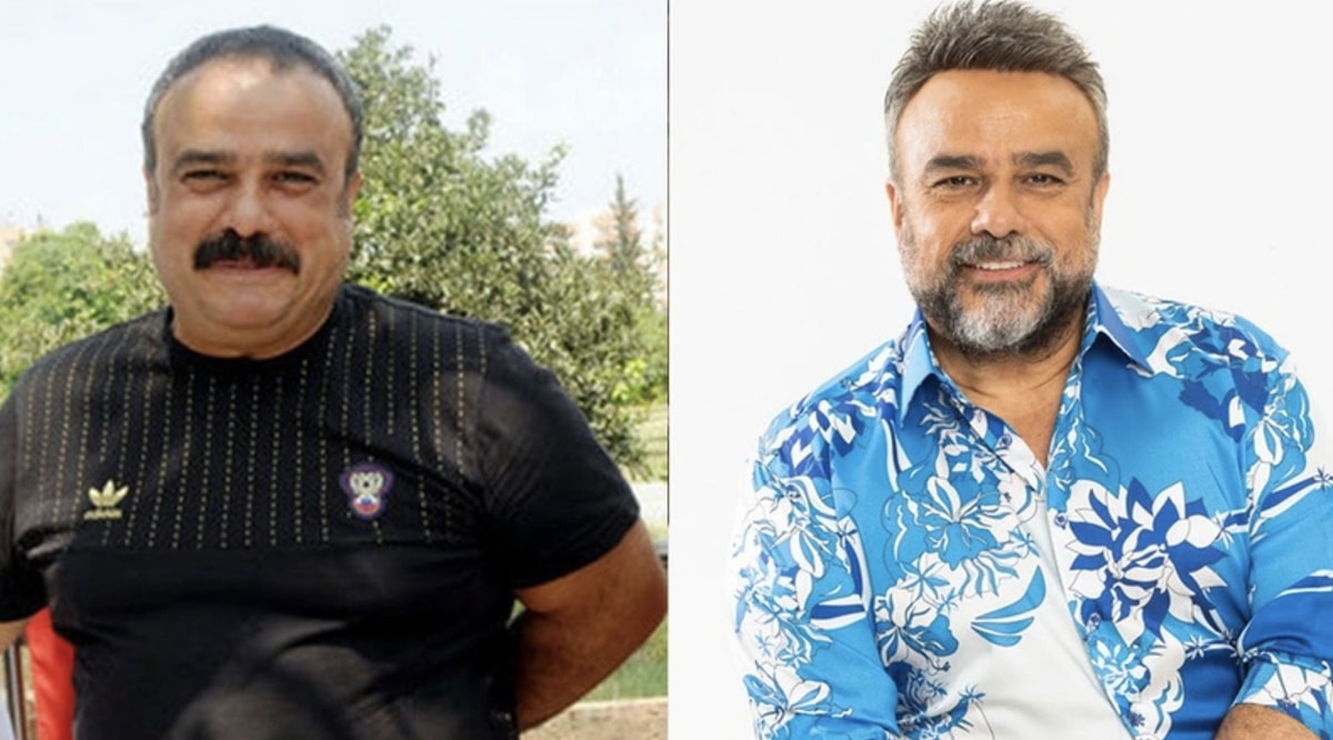 Kimisi Açıkça Söyledi Kimisi İddiaları Reddetti: İşte Protez Saç Kullandığı Söylenen Ünlüler Bulent Serttas - Marmara Bölge Gazetesi