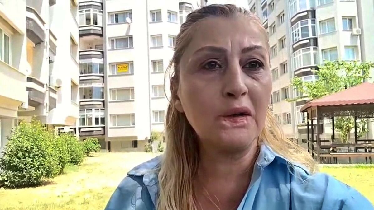 Estetik İşlem Sonrası Dudağı Çürüdü! Estetik Islem Sonrasi Dudagi Curudu 2 - Marmara Bölge Gazetesi