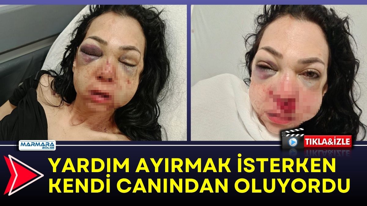 Kocaeli’nin İzmit ilçesinde bir kafede küfür eden grubu uyarmalarının ardından