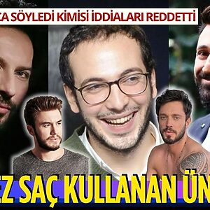 Saç ekimi, protez saç ve kişiye özel saç sistemleri, ünlüler