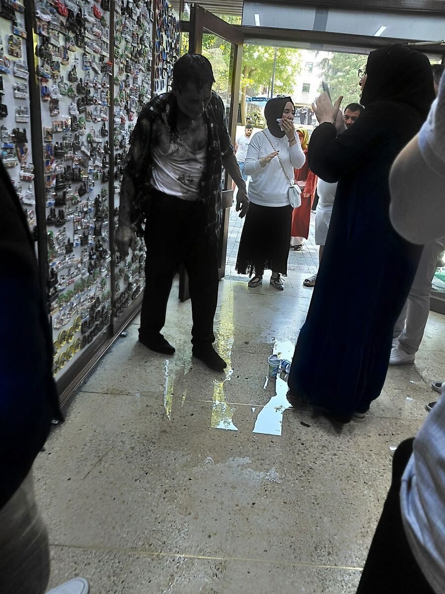 Lavaboyu Açmak İçin Dökülen Kimyasal Madde Patladı! Lavaboyu Acmak Icin Dokulen Kimyasal Madde Patladi 3 - Marmara Bölge Gazetesi