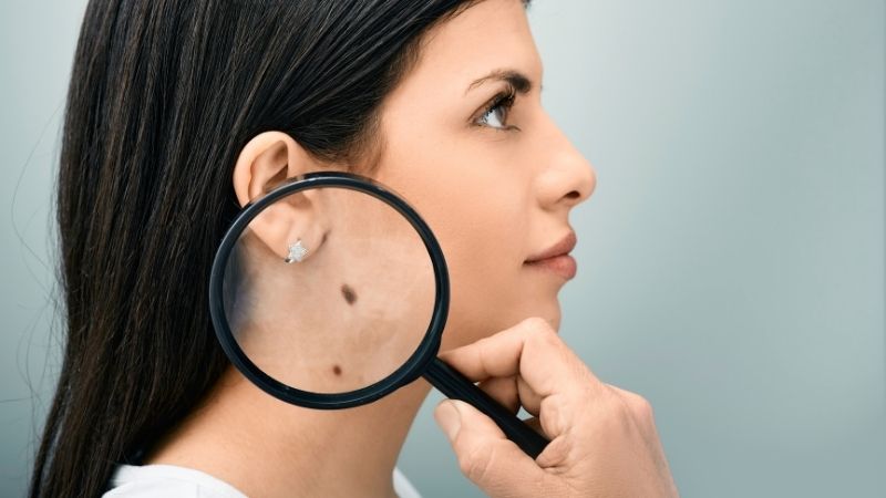 Yazın Lekesiz Bir Cilt İçin Bu 10 Adımı Uygulamak Şart! SILA KUSUMUN SABLONU 2026 07 07T163748.701 - Marmara Bölge Gazetesi