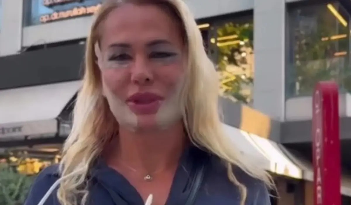 Survivor Sonrası Estetik Kararı! Nagihan Karadere Son Haliyle Gündem Oldu s 5a31f297ab55b6916f781fe5b5329a340109ed43 - Marmara Bölge Gazetesi