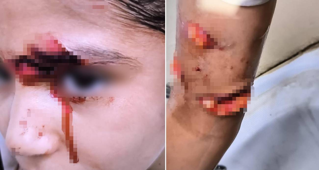 Başıboş Köpekler Dehşet Saçtı yeni proje 61 1784985815 - Marmara Bölge Gazetesi