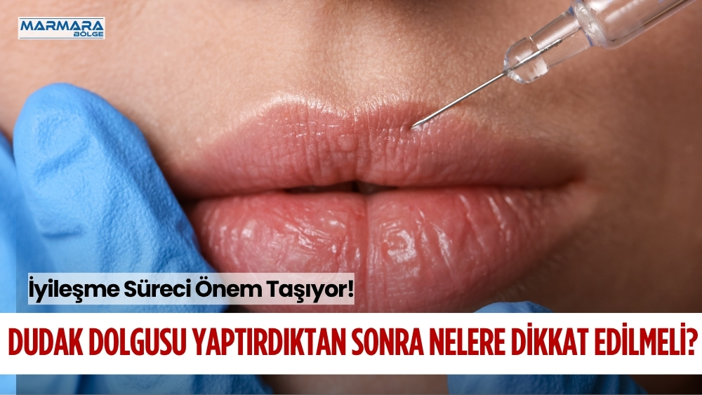 Dudak dolgusu sonrasında istenilen görünümün sağlanması kadar iyileşme sürecinin doğru